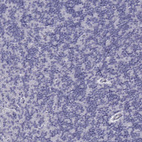 Immunohistochemical staining of human lymph node shows weak to moderate cytoplasmic positivity in lymphoid cells.