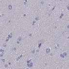 Immunohistochemical staining of human tonsil using Anti-CD3E antibody HPA040957.