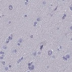 Anti-CD3E Antibody