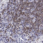 Immunohistochemical staining of human cerebral cortex using Anti-CD3E antibody HPA040957.