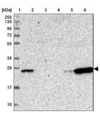 Lane 1: Marker [kDa] 250, 130, 95, 72, 55, 36, 28, 17, 10_br/_Lane 2: Human cell line RT-4_br/_Lane 3: Human cell line U-251 MG_br/_Lane 4: Human plasma_br/_Lane 5: Human Liver tissue_br/_Lane 6: Human Tonsil tissue