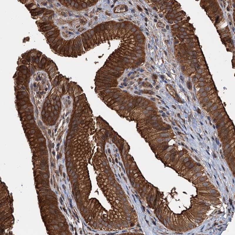 Anti-APOL5 Antibody