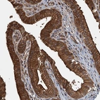 Anti-APOL5 Antibody