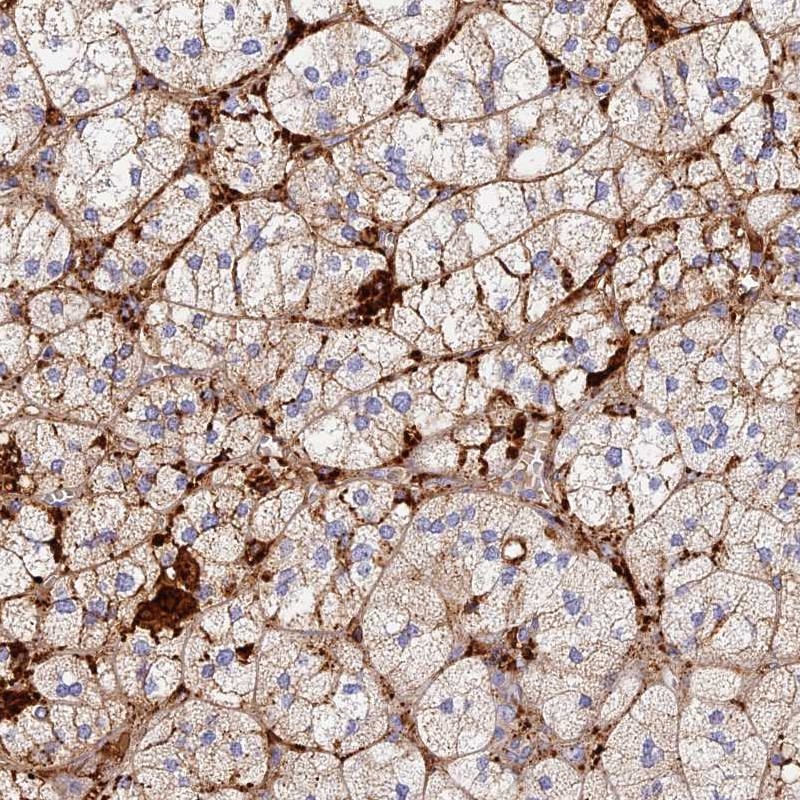 Anti-TLX2 Antibody