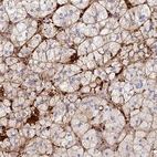 Anti-TLX2 Antibody
