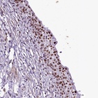 Anti-SAMD10 Antibody