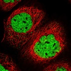 Immunofluorescent staining of human cell line A-431 shows localization to nucleoplasm.