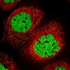 Immunofluorescent staining of human cell line A-431 shows localization to nucleoplasm.