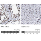 Anti-RALY Antibody