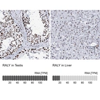 Anti-RALY Antibody