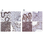 Immunohistochemical staining of human colon, liver, lymph node and testis using Anti-RALY antibody HPA040971 (A) shows similar protein distribution across tissues to independent antibody HPA043614 (B).