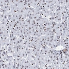 Immunohistochemical staining of human liver shows low expression as expected.