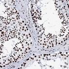 Immunohistochemical staining of human testis shows high expression.