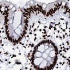 Immunohistochemical staining of human colon using Anti-RALY antibody HPA040971.