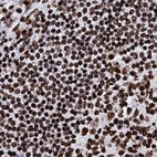 Immunohistochemical staining of human lymph node using Anti-RALY antibody HPA040971.