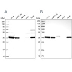 Anti-RALY Antibody