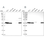 Western blot analysis using Anti-RALY antibody HPA040971 (A) shows similar pattern to independent antibody HPA043614 (B).