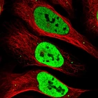 Immunofluorescent staining of human cell line U-2 OS shows localization to nucleoplasm & vesicles.