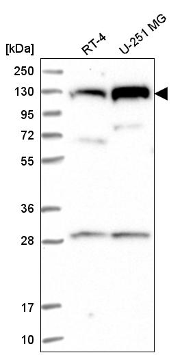 Anti-CHTF18 Antibody