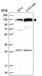Anti-CHTF18 Antibody