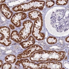Immunohistochemical staining of human kidney shows strong granular cytoplasmic positivity in cells in tubules.