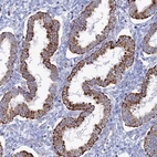 Immunohistochemical staining of human endometrium shows strong granular cytoplasmic positivity in glandular cells.