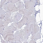 Immunohistochemical staining of human skeletal muscle shows no positivity in myocytes as expected.