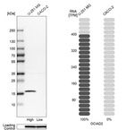 Western blot analysis in human cell lines U-251MG and Caco-2 using Anti-OCIAD2 antibody. Corresponding OCIAD2 RNA-seq data are presented for the same cell lines. Loading control: Anti-GAPDH.