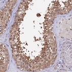 Anti-IPO5 Antibody