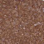 Anti-SNX33 Antibody