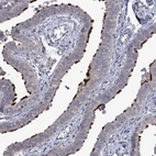 Anti-POMGNT2 Antibody