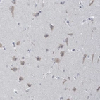 Immunohistochemical staining of human cerebral cortex shows weak to moderate cytoplasmic positivity in neuronal cells.