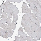 Immunohistochemical staining of human skeletal muscle shows no cytoplasmic positivity in myocytes as expected.