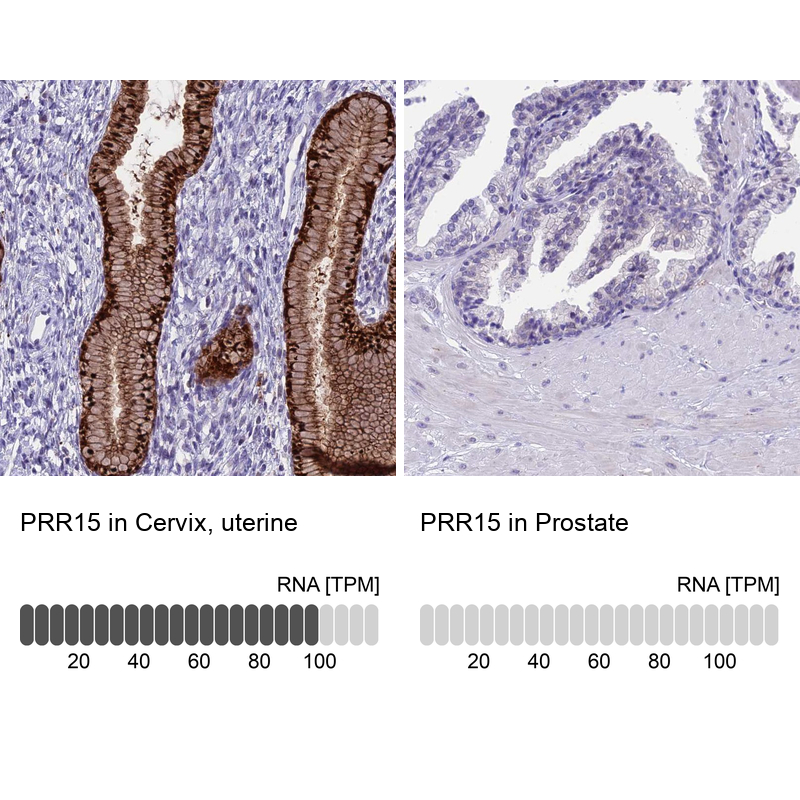 Anti-PRR15 Antibody