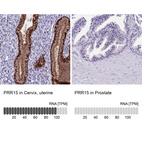 Anti-PRR15 Antibody