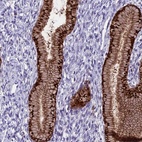 Anti-PRR15 Antibody
