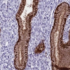 Immunohistochemical staining of human cervix, uterine shows high expression.