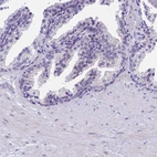 Immunohistochemical staining of human prostate shows low expression as expected.
