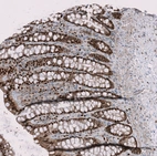 Immunohistochemical staining of human colon shows strong nuclear positivity in lymphoid cells and glandular cells.