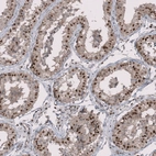 Immunohistochemical staining of human testis shows moderate nuclear positivity in cells in seminiferous ducts.
