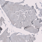 Immunohistochemical staining of human skeletal muscle shows no nuclear positivity in myocytes as expected.