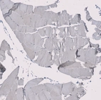 Immunohistochemical staining of human skeletal muscle shows no nuclear positivity in myocytes as expected.