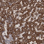 Anti-ROGDI Antibody