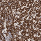 Anti-ROGDI Antibody
