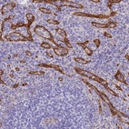 Immunohistochemical staining of human spleen shows strong cytoplasmic positivity in red pulp.