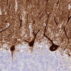 Immunohistochemical staining of human cerebellum shows strong cytoplasmic positivity in Purkinje cells.