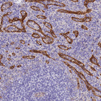 Anti-HOMER3 Antibody