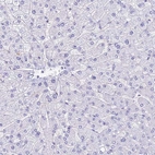 Immunohistochemical staining of human liver shows no positivity in hepatocytes.