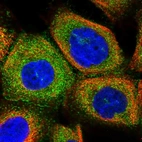 Immunofluorescent staining of human cell line A-431 shows localization to plasma membrane & cytosol.