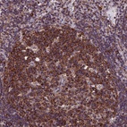 Anti-SLC9A5 Antibody